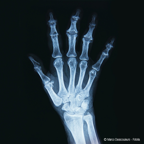 Marco Desscouleurs- Fotollia