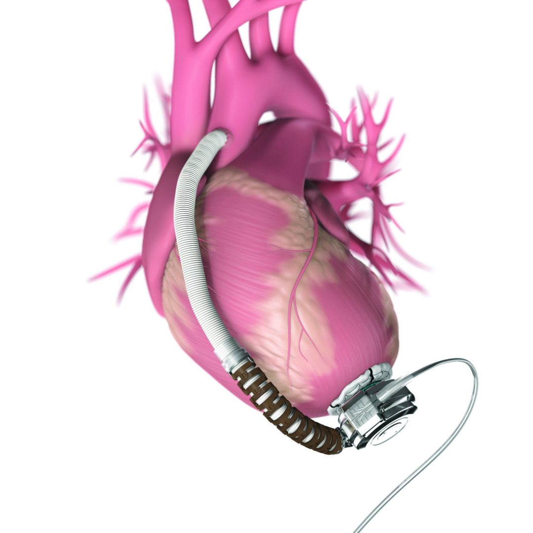 Heartware International